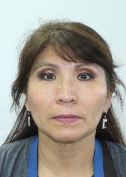 Anita Torres Zevallos