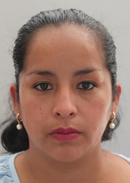 Nelida Gloria Iñigos Balcon